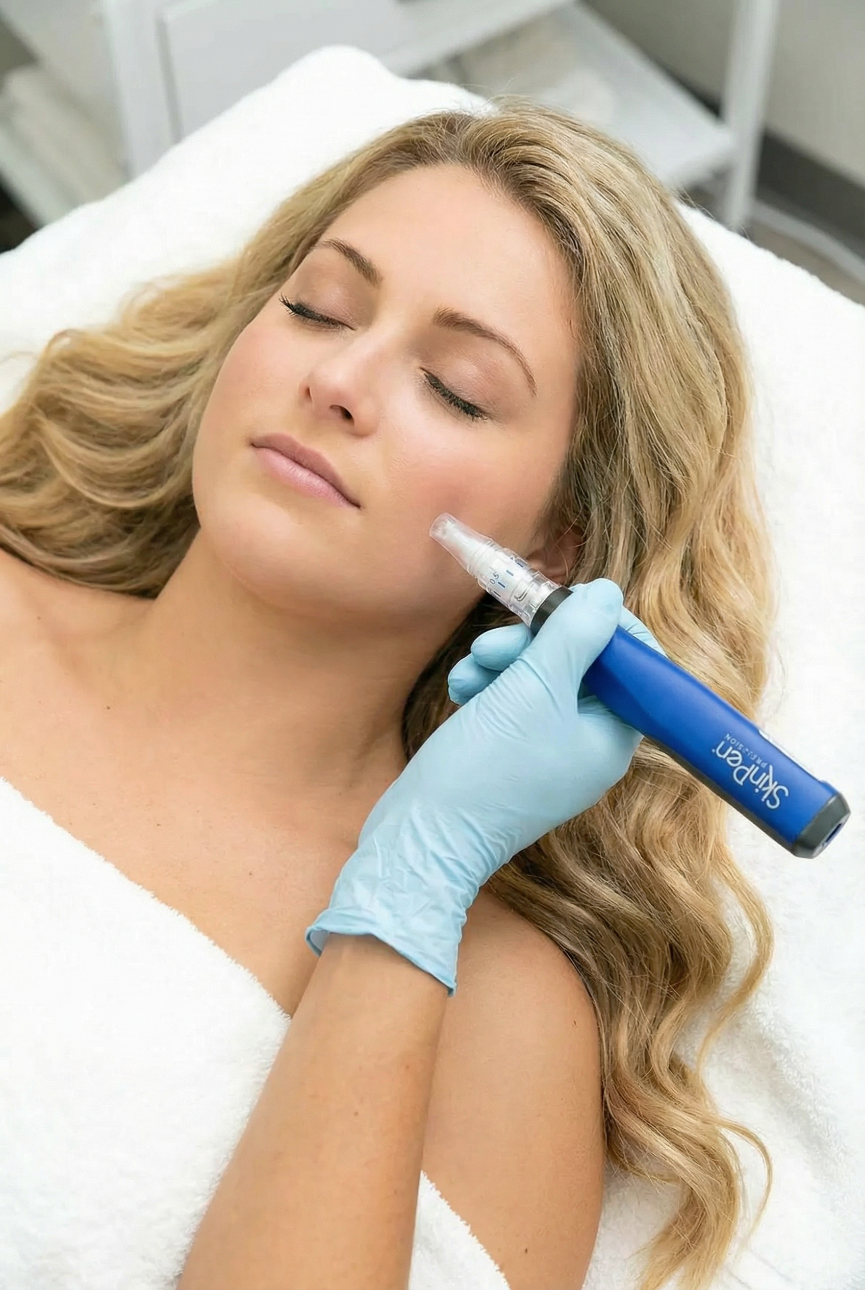 Häufige Fragen zu Microneedling – effektive Hautverjüngung in Graz