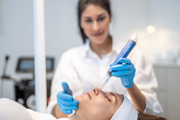 Microneedling in Graz – Warum diese Behandlung als Beauty-Geheimnis vieler Stars gilt